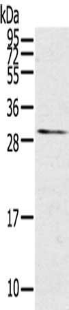 Gel: 12%SDS-PAGE, Lysate: 40 μg, Lane: Mouse kidney tissue, Primary antibody: TNFSF15 Antibody(TNFSF15 Antibody) at dilution 1/600, Secondary antibody: Goat anti rabbit IgG at 1/8000 dilution, Exposure time: 3 minutesRabbit anti-Human TNFSF15 Polyclonal Antibody