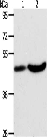 Gel: 10%SDS-PAGE, Lysate: 40 μg, Lane 1-2: Human liver cancer tissue, mouse brain tissue, Primary antibody: PLIN2 Antibody(PLIN2 Antibody) at dilution 1/200, Secondary antibody: Goat anti rabbit IgG at 1/8000 dilution, Exposure time: 40 secondsRabbit anti-Human PLIN2 Polyclonal Antibody