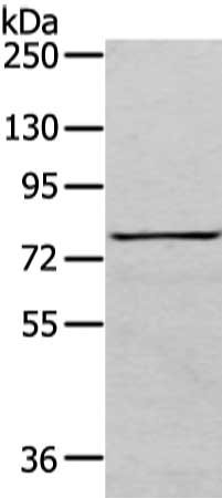 Gel: 6%SDS-PAGE, Lysate: 40 μg, Lane: K562 cell, Primary antibody: COLEC12 Antibody(COLEC12 Antibody) at dilution 1/200 dilution, Secondary antibody: Goat anti rabbit IgG at 1/8000 dilution, Exposure time: 3 minutesRabbit anti-Human COLEC12 Polyclonal Antibody