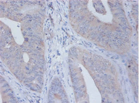 Immunohistochemistry of paraffin-embedded human placenta tissue using the antibody at dilution of 1:100