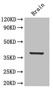 Western Blot  | Positive WB detected in: Mouse brain tissue  | All lanes: IL12B antibody at 4µg/ml  | Secondary  | Goat polyclonal to rabbit IgG at 1/50000 dilution  | Predicted band size: 38 kDa  | Observed band size: 38 kDaRabbit anti-Human IL12B Polyclonal Antibody