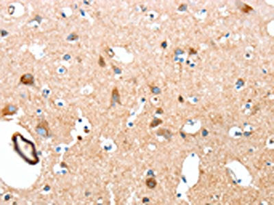 The image on the left is immunohistochemistry of paraffin-embedded Human brain tissue using the antibody Antibody) at dilution 1/50, on the right is treated with synthetic peptide. (Original magnification: ×200)