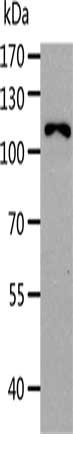 Gel: 8%SDS-PAGE, Lysate: 40 μg, Lane: K562 cells, Primary antibody: AARS Antibody(AARS Antibody) at dilution 1/283, Secondary antibody: Goat anti rabbit IgG at 1/8000 dilution, Exposure time: 1 minute