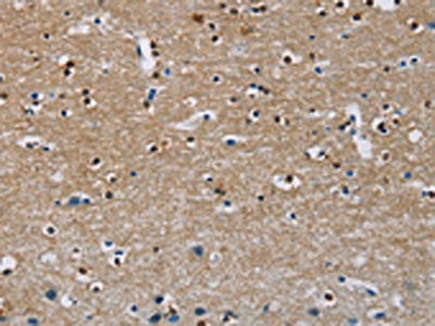 The image on the left is immunohistochemistry of paraffin-embedded Human brain  tissue using MSH5 Antibody(MSH5 Antibody) at dilution 1/30, on the right is treated with fusion protein. (Original magnification: ×200)