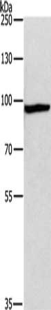 Gel: 6%SDS-PAGE, Lysate: 40 μg, Lane: Mouse bladder tissue, Primary antibody: MSH5 Antibody(MSH5 Antibody) at dilution 1/200, Secondary antibody: Goat anti rabbit IgG at 1/8000 dilution, Exposure time: 30 seconds