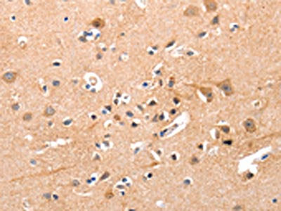 The image on the left is immunohistochemistry of paraffin-embedded Human brain tissue using YWHAG Antibody(YWHAG Antibody) at dilution 1/50, on the right is treated with synthetic peptide. (Original magnification: ×200)Rabbit anti-Human YWHAG Polyclonal Antibody