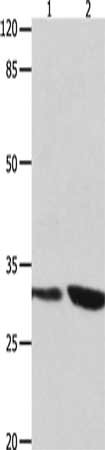 Gel: 10%SDS-PAGE, Lysate: 40 μg, Lane 1-2: 293T cells, Jurkat cells, Primary antibody: YWHAG Antibody(YWHAG Antibody) at dilution 1/800, Secondary antibody: Goat anti rabbit IgG at 1/8000 dilution, Exposure time: 10 secondsRabbit anti-Human YWHAG Polyclonal Antibody