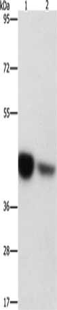 Gel: 10%SDS-PAGE, Lysate: 40 μg, Lane 1-2: A431 cells, mouse brain tissue, Primary antibody: IDH3G Antibody(IDH3G Antibody) at dilution 1/300, Secondary antibody: Goat anti rabbit IgG at 1/8000 dilution, Exposure time: 15 secondsRabbit anti-Human IDH3G Polyclonal Antibody