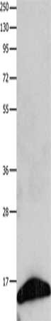 Gel: 8+12%SDS-PAGE, Lysate: 30 μg, Lane: Human fetal brain tissue, Primary antibody: FABP7 Antibody(FABP7 Antibody) at dilution 1/350, Secondary antibody: Goat anti rabbit IgG at 1/8000 dilution, Exposure time: 30 secondsRabbit anti-Human FABP7 Polyclonal Antibody