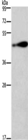 Gel: 8%SDS-PAGE,Lysate: 40 μg,,Primary antibody: AGER Antibody(AGER Antibody) at dilution 1/750 dilution,Secondary antibody: Goat anti rabbit IgG at 1/8000 dilution,Exposure time: 2 minutesRabbit anti-Human AGER Polyclonal Antibody