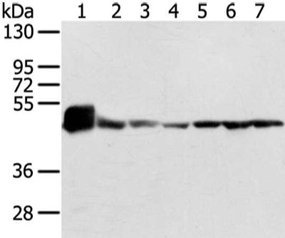 Gel: 8%SDS-PAGE, Lysate: 40 μg, Lane 1-7: Mouse heart tissue and lo2 cell, 231 cell and human fetal brain tissue, A431, hela and 293T cell, Primary antibody: UQCRC1 Antibody(UQCRC1 Antibody) at dilution 1/200 dilution, Secondary antibody: Goat anti rabbit IgG at 1/8000 dilution, Exposure time: 1 secondRabbit anti-Human UQCRC1 Polyclonal Antibody