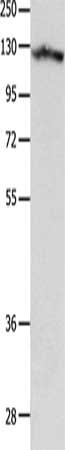Gel: 8%SDS-PAGE, Lysate: 40 μg, Lane: Human leiomyosarcoma tissue, Primary antibody: MCAM Antibody(MCAM Antibody) at dilution 1/850, Secondary antibody: Goat anti rabbit IgG at 1/8000 dilution, Exposure time: 10 seconds
