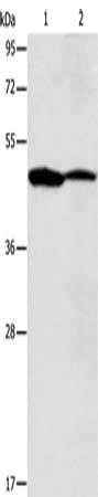 Gel: 10%SDS-PAGE, Lysate: 40 μg, Lane 1-2: Mouse brain tissue, Jurkat cells, Primary antibody: ACTR3B Antibody(ACTR3B Antibody) at dilution 1/350, Secondary antibody: Goat anti rabbit IgG at 1/8000 dilution, Exposure time: 10 seconds