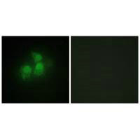 Immunofluorescence analysis of HepG2 cells, using IPPK antibody.