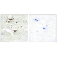Immunohistochemistry analysis of paraffin-embedded human brain tissue, using IPPK antibody.