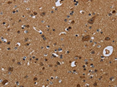 The image on the left is immunohistochemistry of paraffin-embedded Human brain  tissue using NDUFS8 Antibody(NDUFS8 Antibody) at dilution 1/50, on the right is treated with fusion protein. (Original magnification: ×200)Rabbit anti-Human NDUFS8 Polyclonal Antibody
