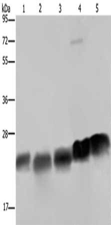 Gel: 10%SDS-PAGE, Lysate: 40 μg, Lane 1-5: K562 cells, Hela cells, Jurkat cells, mouse heart tissue, Mouse spleen tissue, Primary antibody: NDUFS8 Antibody(NDUFS8 Antibody) at dilution 1/250, Secondary antibody: Goat anti rabbit IgG at 1/8000 dilution, Exposure time: 5 secondsRabbit anti-Human NDUFS8 Polyclonal Antibody