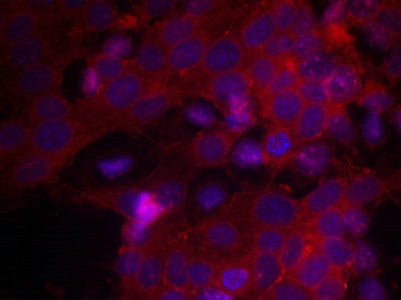 Immunofluorescence staining of methanol-fixed MCF cells using IGF-1R(Ab-1161) Antibody.Rabbit anti-Human IGF1R Polyclonal Antibody