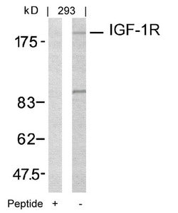 Western blot analysis of extracts from 293 cells using IGF-1R(Ab-1161) Antibody and the same antibody preincubated with blocking peptide.