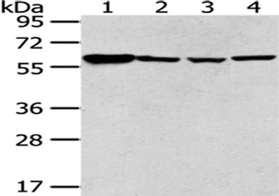 Gel: 8%SDS-PAGE, Lysate: 40 μg, Lane 1-4: Raji, NIH/3T3, hepg2 and A549 cell, Primary antibody: PKM Antibody(PKM Antibody) at dilution 1/250 dilution, Secondary antibody: Goat anti rabbit IgG at 1/8000 dilution, Exposure time: 10 secondsRabbit anti-Human PKM Polyclonal Antibody
