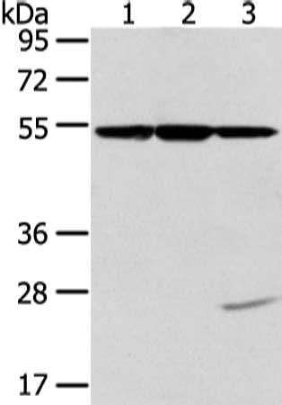 Gel: 8%SDS-PAGE, Lysate: 40 μg, Lane 1-3: Hela, K562 and NIH/3T3 cell, Primary antibody: TUBA1C Antibody(TUBA1C Antibody) at dilution 1/400 dilution, Secondary antibody: Goat anti rabbit IgG at 1/8000 dilution, Exposure time: 10 secondsRabbit anti-Human TUBA1C Polyclonal Antibody