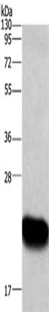 Gel: 10%SDS-PAGE, Lysate: 40 μg, Lane: Human fetal liver tissue, Primary antibody: ARL4A Antibody(ARL4A Antibody) at dilution 1/666, Secondary antibody: Goat anti rabbit IgG at 1/8000 dilution, Exposure time: 1 minuteRabbit anti-Human ARL4A Polyclonal Antibody