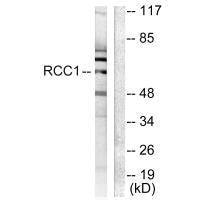 Western blot analysis of extracts from LOVO cells, using RCC1 antibody.Rabbit anti-Human RCC1 Polyclonal Antibody