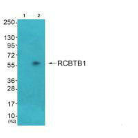 Western blot analysis of extracts from HepG2  cells (Lane 2), cells (Lane 3) and cells (Lane 4), using RCC1 antiobdy. The lane on the left is treated with systhesized peptide.Rabbit anti-Human RCC1 Polyclonal Antibody