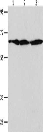 Gel: 10+12%SDS-PAGE, Lysate: 30 μg, Lane 1-3: NIH/3T3 cells, Hela cells, 293T cells, Primary antibody: AIFM1 Antibody(AIFM1 Antibody) at dilution 1/600, Secondary antibody: Goat anti rabbit IgG at 1/8000 dilution, Exposure time: 20 secondsRabbit anti-Human AIFM1 Polyclonal Antibody