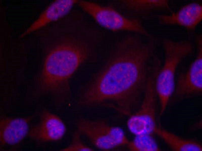 Immunofluorescence staining of methanol-fixed Hela cells using JNK1/JNK2/JNK3(phospho-Thr183/Tyr185) Antibody.Rabbit anti-Human MAPK8/MAPK9/MAPK10 Polyclonal Antibody