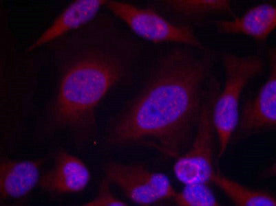 Immunofluorescence staining of methanol-fixed Hela cells using JNK1/JNK2/JNK3(phospho-Thr183/Tyr185) Antibody.Rabbit anti-Human MAPK8/MAPK9/MAPK10 Polyclonal Antibody