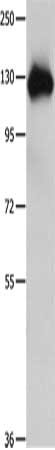 Gel: 10%SDS-PAGE, Lysate: 60 μg, Lane: Mouse lung tissue, Primary antibody: AMPH Antibody(AMPH Antibody) at dilution 1/400, Secondary antibody: Goat anti rabbit IgG at 1/8000 dilution, Exposure time: 1 minuteRabbit anti-Human AMPH Polyclonal Antibody