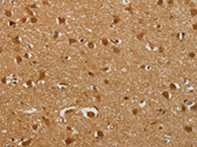 The image on the left is immunohistochemistry of paraffin-embedded Human brain  tissue using AHSG Antibody(AHSG Antibody) at dilution 1/60, on the right is treated with fusion protein. (Original magnification: ×200)Rabbit anti-Human AHSG Polyclonal Antibody