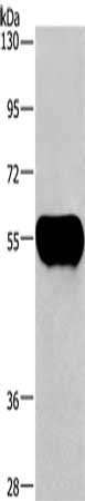Gel: 10%SDS-PAGE, Lysate: 2 μg, Lane: Human plasma tissue, Primary antibody: AHSG Antibody(AHSG Antibody) at dilution 1/1350, Secondary antibody: Goat anti rabbit IgG at 1/8000 dilution, Exposure time: 10 secondsRabbit anti-Human AHSG Polyclonal Antibody