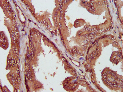 IHC image of MIF Antibody diluted at 1:400 and staining in paraffin-embedded human prostate tissue performed on a Leica BondTM system. After dewaxing and hydration, antigen retrieval was mediated by high pressure in a citrate buffer (pH 6.0). Section was blocked with 10% normal goat serum 30min at RT. Then primary antibody (1% BSA) was incubated at 4°C overnight. The primary is detected by a biotinylated secondary antibody and visualized using an HRP conjugated SP system.