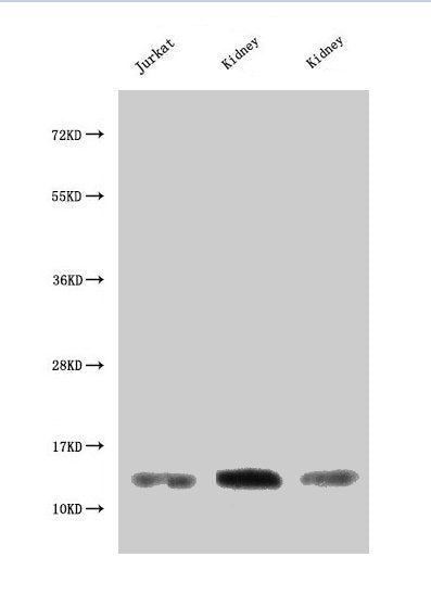 Western Blot  | Positive WB detected in: Jurkat whole cell lysate, Rat kidney tissue, Mouse kidney tissue  | All lanes: MIF antibody at 3µg/ml  | Secondary  | Goat polyclonal to rabbit IgG at 1/50000 dilution  | Predicted band size: 13 kDa  | Observed band size: 13 kDa