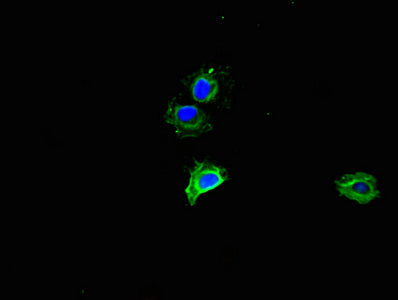 Immunofluorescent analysis of Hela cells using MMP2 Antibody at dilution of 1:100 and Alexa Fluor 488-congugated AffiniPure Goat Anti-Rabbit IgG(H+L)Rabbit anti-Human MMP2 Polyclonal Antibody