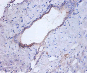 Immunohistochemistry of paraffin-embedded human liver tissue using the antibody at dilution of 1:100Rabbit anti-Human CTSB Polyclonal Antibody