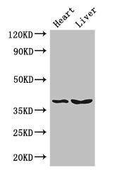 Western Blot  | Positive WB detected in: Mouse heart tissue, Mouse liver tissue  | All lanes: CTSB antibody at 3µg/ml  | Secondary  | Goat polyclonal to rabbit IgG at 1/50000 dilution  | Predicted band size: 38 kDa  | Observed band size: 38 kDaRabbit anti-Human CTSB Polyclonal Antibody
