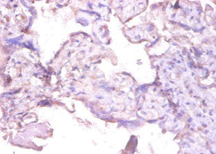 Immunohistochemistry of paraffin-embedded human placenta tissue using MMP1 Antibody at dilution of 1:100Rabbit anti-Human MMP1 Polyclonal Antibody