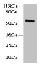 Western blotAll lanes: MMP1 antibody at 2µg/ml + 293T whole cell lysateSecondaryGoat polyclonal to rabbit IgG at 1/10000 dilutionPredicted band size: 55 kDaObserved band size: 55 kDaRabbit anti-Human MMP1 Polyclonal Antibody