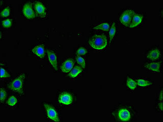 Immunofluorescent analysis of PC-3 cells using MMP13 Antibody at dilution of 1:100 and Alexa Fluor 488-congugated AffiniPure Goat Anti-Rabbit IgG(H+L)Rabbit anti-Human MMP13 Polyclonal Antibody