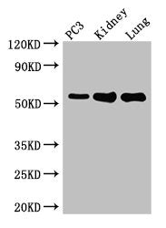 Western Blot  | Positive WB detected in: PC-3 whole cell lysate, Mouse kidney tissue, Mouse lung tissue  | All lanes: MMP13 antibody at 2µg/ml  | Secondary  | Goat polyclonal to rabbit IgG at 1/50000 dilution  | Predicted band size: 54 kDa  | Observed band size: 54 kDaRabbit anti-Human MMP13 Polyclonal Antibody