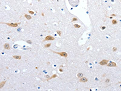 The image on the left is immunohistochemistry of paraffin-embedded Human brain tissue using the antibody Antibody) at dilution 1/25, on the right is treated with synthetic peptide. (Original magnification: ×200)Rabbit anti-Human RBFOX3 Polyclonal Antibody