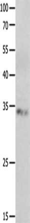 Gel: 10%SDS-PAGE, Lysate: 40 μg, Lane: Jurkat cells, Primary antibody: RBFOX3 Antibody(RBFOX3 Antibody) at dilution 1/550, Secondary antibody: Goat anti rabbit IgG at 1/8000 dilution, Exposure time: 30 secondsRabbit anti-Human RBFOX3 Polyclonal Antibody