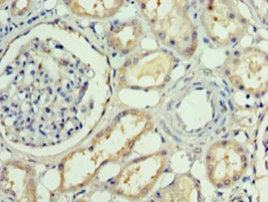 Immunohistochemistry of paraffin-embedded human kidney tissue using RBP4 Antibody at dilution of 1:100Rabbit anti-Human RBP4 Polyclonal Antibody