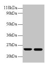 Western blot  | All lanes: RBP4 antibody at 2µg/ml  | Lane 1: Human positive serum at 1: 10  | Lane 2: Human positive serum at 1: 100  | Secondary  | Goat polyclonal to rabbit IgG at 1/50000 dilution  | Predicted band size: 24 kDa  | Observed band size: 24 kDaRabbit anti-Human RBP4 Polyclonal Antibody
