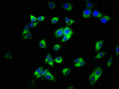 Immunofluorescence staining of HepG2 cells with the antibody at 1:200, counter-stained with DAPI. The cells were fixed in 4% formaldehyde, permeabilized using 0.2% Triton X-100 and blocked in 10% normal Goat Serum. The cells were then incubated with the antibody overnight at 4°C. The secondary antibody was Alexa Fluor 488-congugated AffiniPure Goat Anti-Rabbit IgG(H+L).Rabbit anti-Human CD14 Polyclonal Antibody