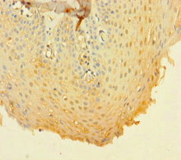 Immunohistochemistry of paraffin-embedded human tonsil tissue using CD14 Antibody at dilution of 1:100Rabbit anti-Human CD14 Polyclonal Antibody