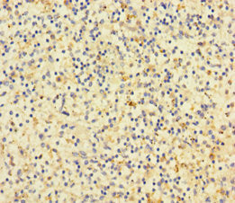 Immunohistochemistry of paraffin-embedded human spleen tissue using CD14 Antibody at dilution of 1:100Rabbit anti-Human CD14 Polyclonal Antibody